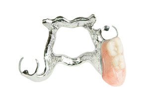 RPD-removable-denture_img