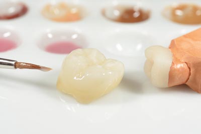 ceramic-crown