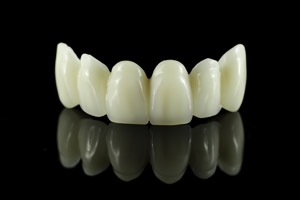 ceramic-crowns