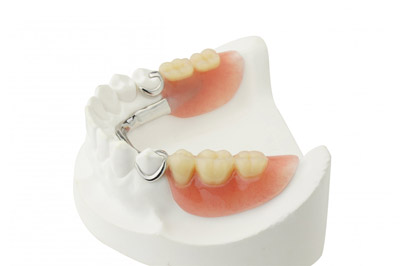 clear-partial-denture_img