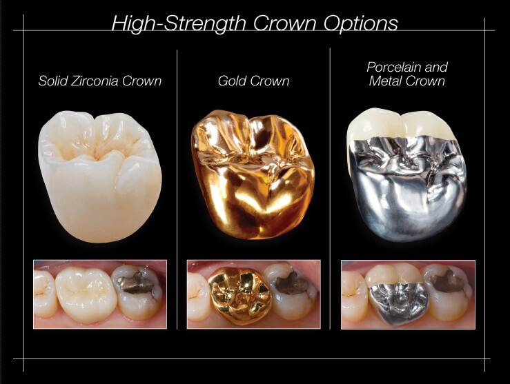 crownproscons2