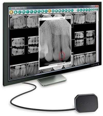 digital-xrays_images