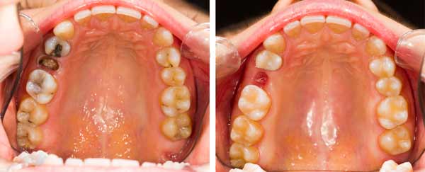 extraction-example_images