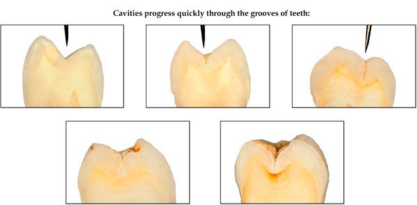sealants_image_1