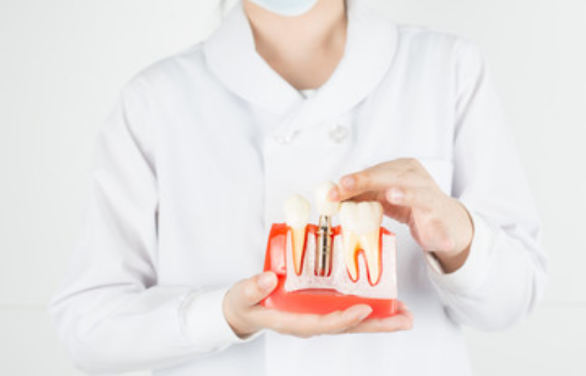 Am I An Ideal Candidate For Dental Implants?