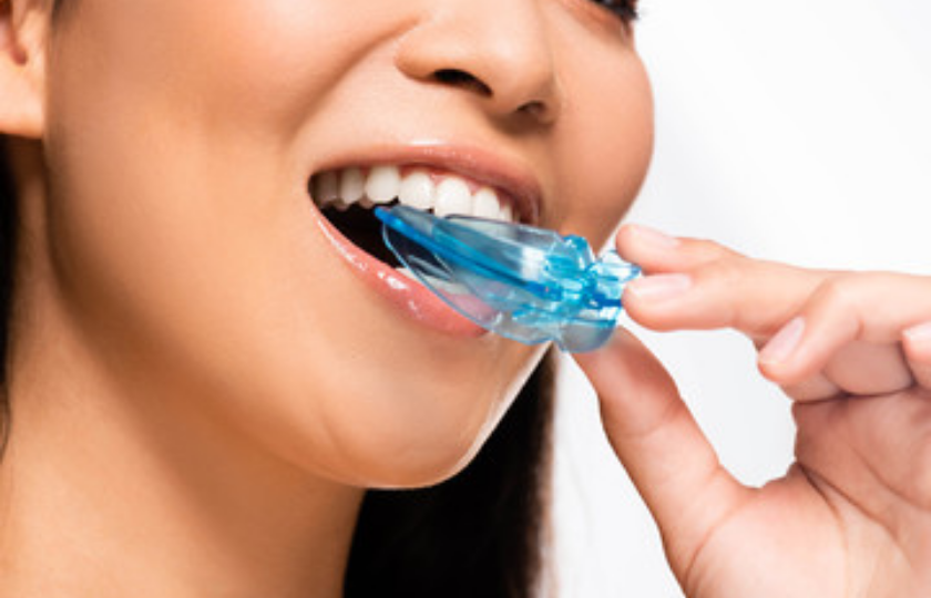 Why should you prefer a custom-made night guard for bruxism?