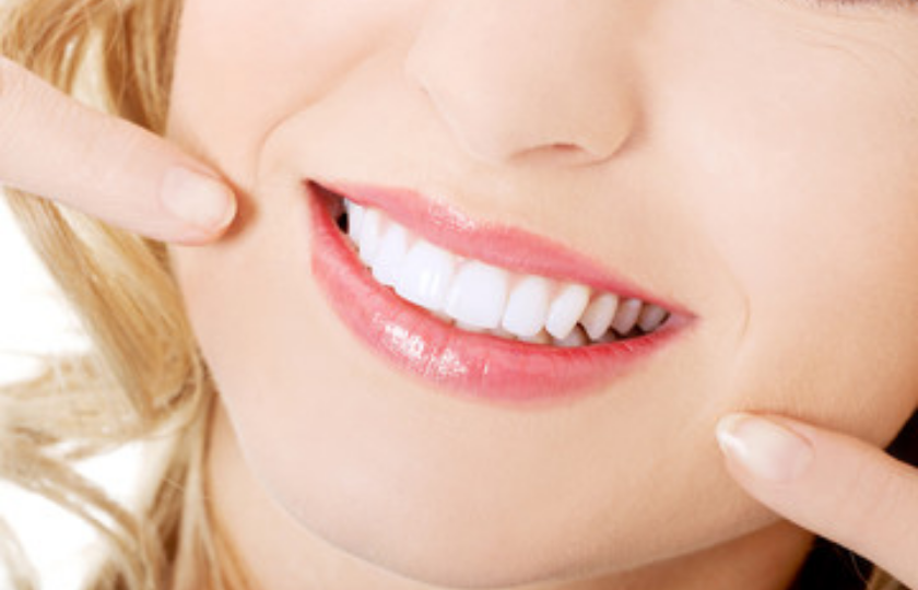 Few Reasons to Have Teeth Whitening Done by a Dentist