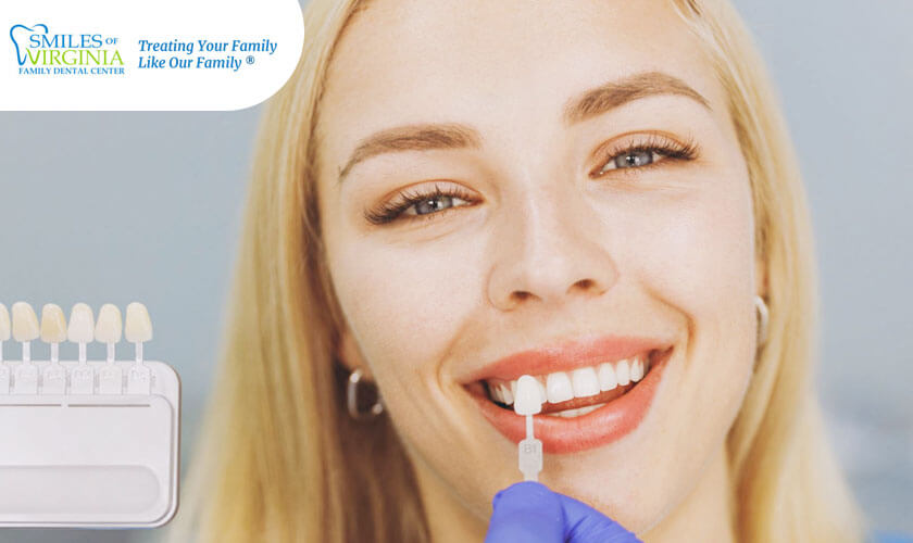 Is Dental Bonding As Good As Veneers?