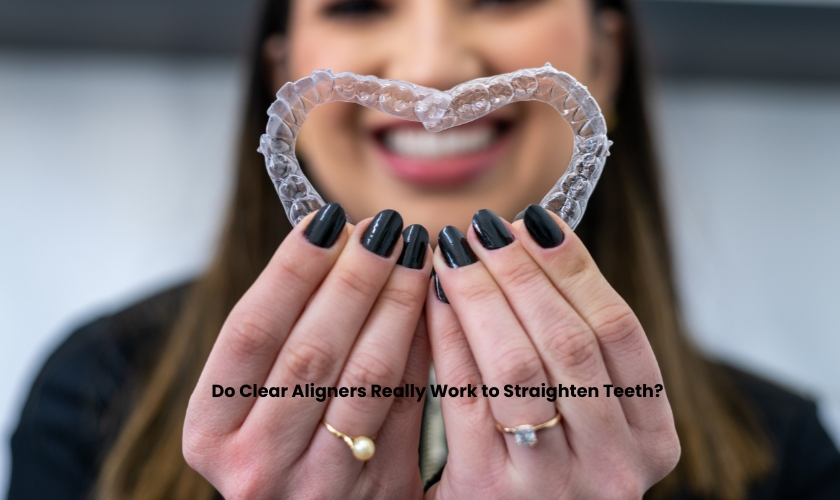 Do Clear Aligners Really Work to Straighten Teeth?