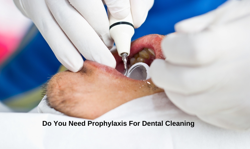 Prophylaxis For Dental Cleaning