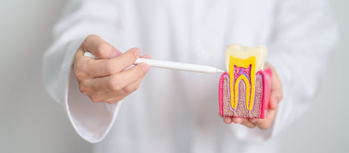 Root Canal Treatment in Winchester