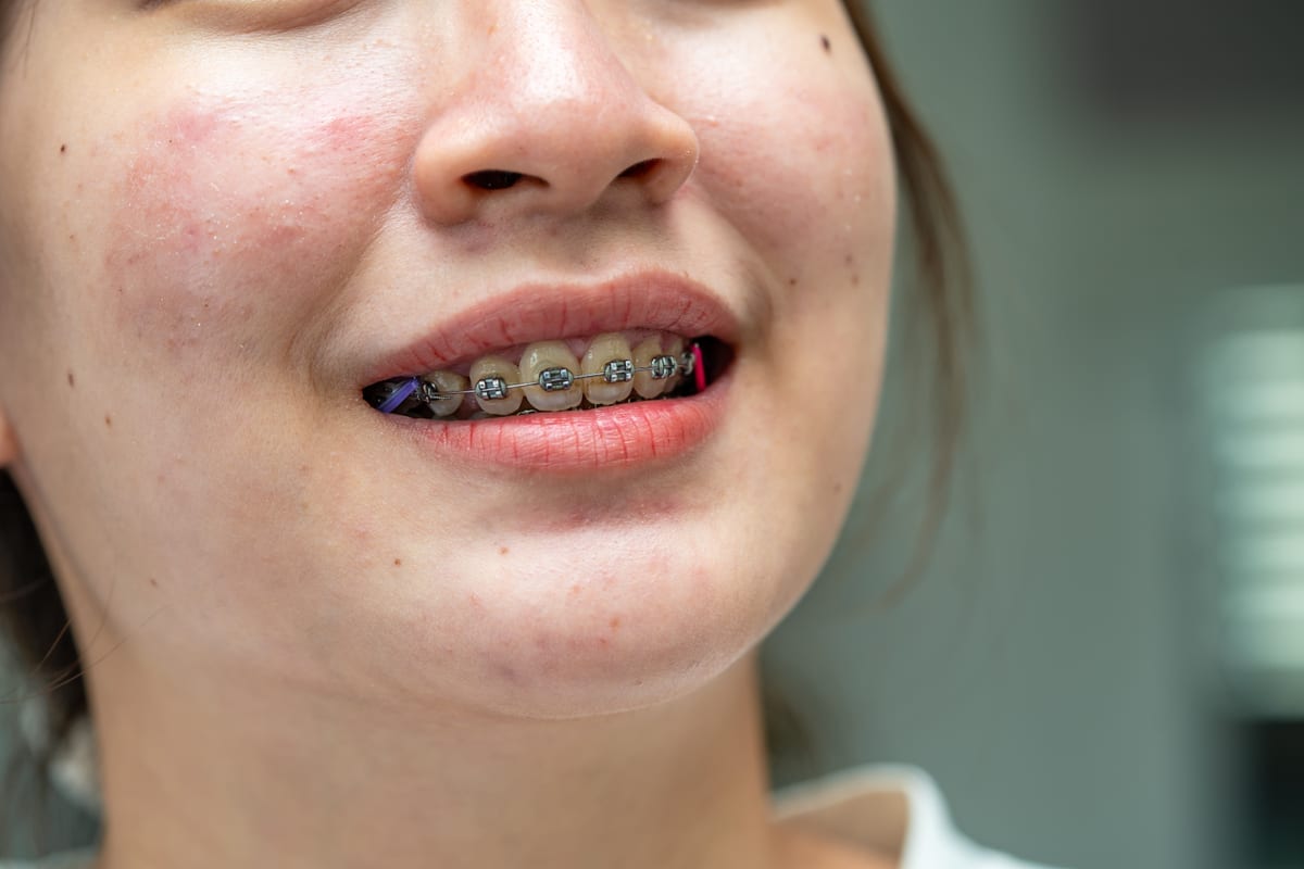 Orthodontics in Winchester
